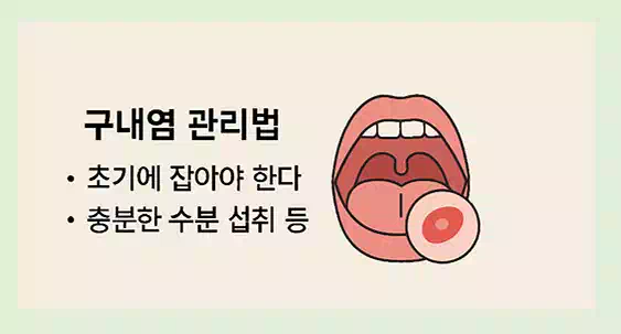 혓바늘 3일 완치 도전! 구내염 빨리 낫는 법과 관리법 총정리 2 구내염 빨리 낫는법_관리