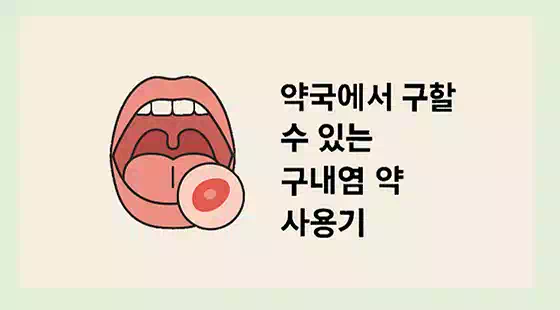 혓바늘 3일 완치 도전! 구내염 빨리 낫는 법과 관리법 총정리 3 구내염 빨리 낫는법_약
