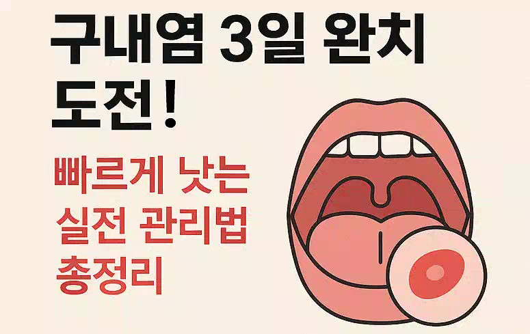 구내염 빨리 낫는법_배너
